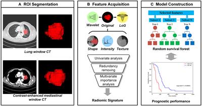 Progression-Free Survival Prediction in Small Cell Lung Cancer Based on Radiomics Analysis of Contrast-Enhanced CT